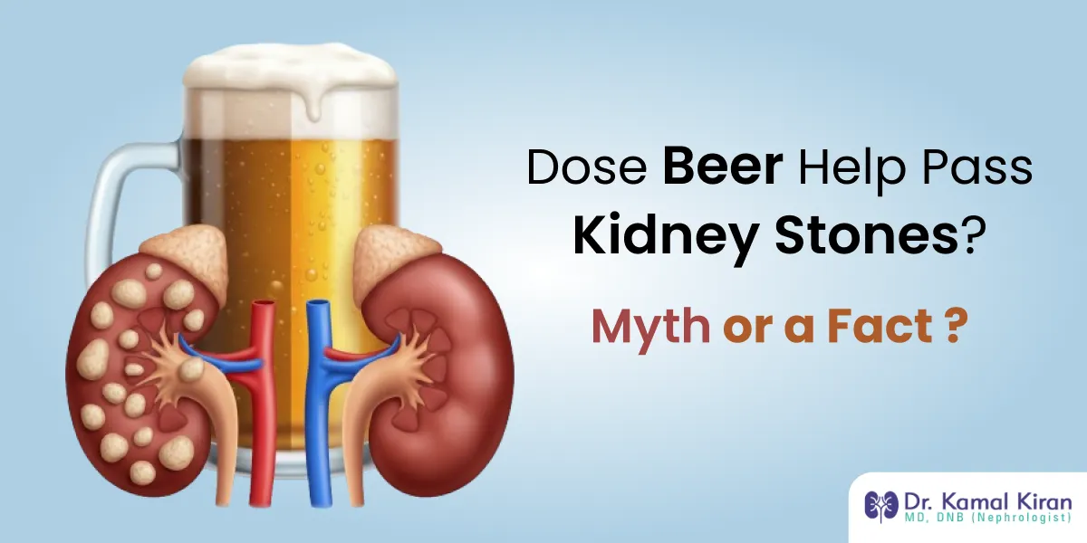 Beer and Kidney Stones