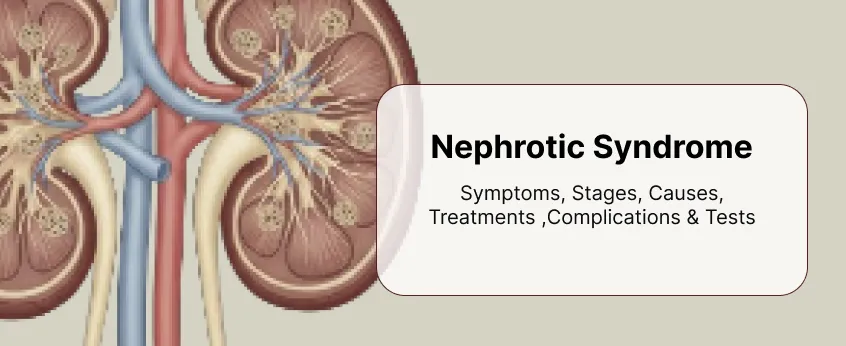 Nephrotic Syndrome