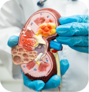 Kidney Disease