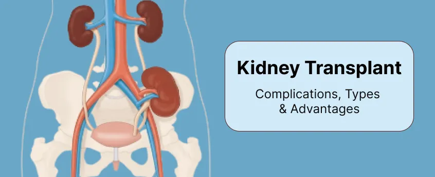 Kidney Transplant